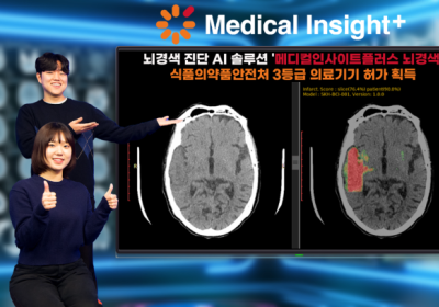 SK C&C, 뇌경색 진단 AI 솔루션 식약처 허가 획득
